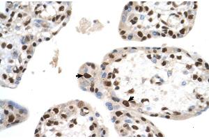 SETD2 antibody - N-terminal region  validated by IHC using Human Placenta lysate at 4. (SETD2 anticorps  (N-Term))