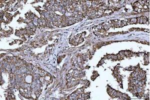 IHC analysis of DTR/HBEGF using anti-DTR/HBEGF antibody (ABIN7603042).