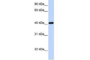 WB Suggested Anti-IRX6 Antibody Titration:  0. (IRX6 anticorps  (N-Term))
