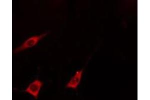 ABIN6275378 staining  293 cells by IF/ICC.