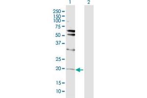 Western Blot analysis of VHL expression in transfected 293T cell line by VHL MaxPab polyclonal antibody. (VHL anticorps  (AA 1-172))