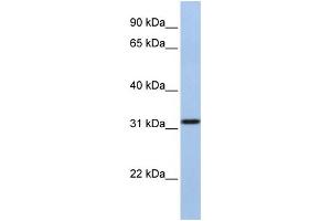 WB Suggested Anti-SLC25A28 Antibody Titration:  1 ug/ml  Positive Control:  MCF-7 whole cell lysates (SLC25A28 anticorps  (C-Term))
