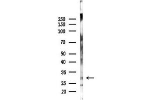Western blot analysis of lysates from Rat brain, using CCDC90B Antibody at 1/1000 dilution.