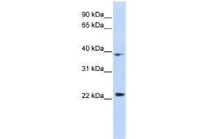 WB Suggested Anti-PRR11 Antibody Titration:  0. (PRR11 anticorps  (Middle Region))