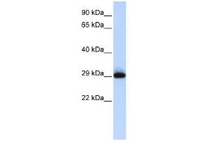 WB Suggested Anti-SUSD3 Antibody Titration: 0.