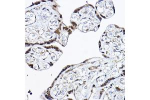 Immunohistochemistry of paraffin-embedded human placenta using [KO Validated] PDCD4 Rabbit pAb (ABIN3023387, ABIN3023388, ABIN3023389 and ABIN1681284) at dilution of 1:25 (40x lens). (PDCD4 anticorps  (AA 1-260))