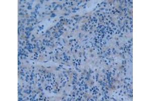 IHC-P analysis of Kidney tissue, with DAB staining. (PTPRH anticorps  (AA 551-802))