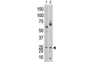 The BNIP3 antibody western blot analysis of Ramos cell lysate (lane 1) and in mouse brain tissue lysate (2).