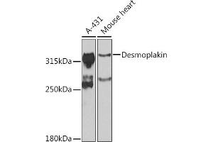 Western blot analysis of extracts of various cell lines, using Desmoplakin antibody (ABIN6134106, ABIN6139838, ABIN6139840 and ABIN6223548) at 1:1000 dilution. (Desmoplakin anticorps  (AA 1-100))