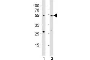 Western blot testing of EED antibody at 1:1000 dilution.