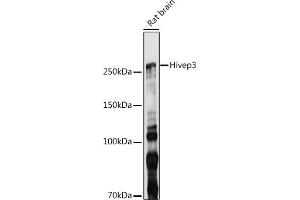 Western blot analysis of extracts of Rat brain, using Hivep3 antibody (ABIN7267792) at 1:1000 dilution. (Human Immunodeficiency Virus Type I Enhancer Binding Protein 3 (HIVEP3) anticorps)