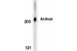 Western blot analysis of Acinus in K562 whole cell lysate with AP30011PU-N Acinus antibody at 0. (ACIN1 anticorps  (C-Term))