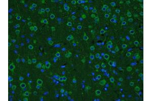 Paraformaldehyde-fixed, paraffin embedded rat brain; Antigen retrieval by boiling in sodium citrate buffer (pH6. (GDNF anticorps  (AA 121-211) (FITC))