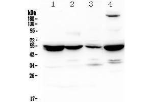 Western blot analysis of Adenylosuccinate Lyase using anti-Adenylosuccinate Lyase antibody . (ASL anticorps)