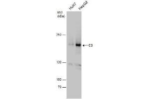 WB Image C3 antibody detects C3 protein by western blot analysis. (C3 anticorps  (C-Term))