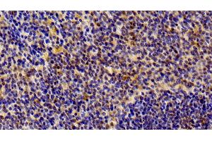Detection of STAT6 in Rat Spleen Tissue using Polyclonal Antibody to Signal Transducer And Activator Of Transcription 6 (STAT6) (STAT6 anticorps  (AA 557-841))