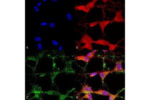Immunocytochemistry/Immunofluorescence analysis using Mouse Anti-TrpV3 Monoclonal Antibody, Clone S15-39 (ABIN2485232).