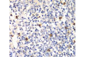 Immunohistochemistry of paraffin-embedded Mouse spleen using PSMD7 Polyclonal Antibody at dilution of 1:100 (40x lens).