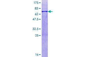 Image no. 1 for beta-1,3-Glucuronyltransferase 3 (Glucuronosyltransferase I) (B3GAT3) (AA 1-335) protein (GST tag) (ABIN1346290)