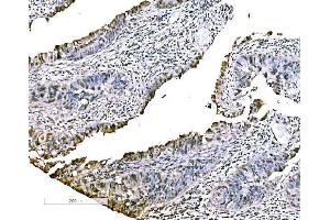 IHC analysis of CBX2 using anti-CBX2 antibody (ABIN7599466). (CBX2 anticorps  (AA 1-532))