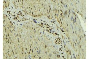 ABIN6277139 at 1/100 staining Mouse muscle tissue by IHC-P. (MAX anticorps  (N-Term))