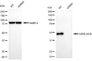 Western blotting analysis using HARS1 antibody (ABIN7798918). (Histidine--tRNA Ligase (HARS-1) anticorps)