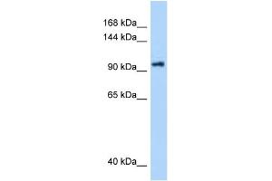 WB Suggested Anti-DHX16 Antibody Titration: 0. (DHX16 anticorps  (N-Term))