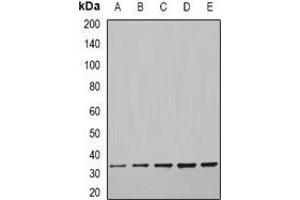 Western blot analysis of CFDP1 expression in MCF7 (A), SKOV3 (B), mouse brain (C), mouse liver (D), rat spleen (E) whole cell lysates.