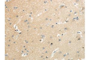 Immunohistochemistry (IHC) image for anti-Solute Carrier Family 7, (Cationic Amino Acid Transporter, Y+ System) Member 11 (SLC7A11) antibody (ABIN5959338) (SLC7A11 anticorps)