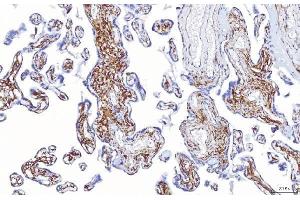 IHC analysis of ENPP1/PC1 using anti-ENPP1/PC1 antibody (ABIN7601410). (ENPP1 anticorps  (AA 347-789))