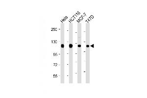 All lanes : Anti-RBBP8 Antibody (C-term) at 1:2000 dilution Lane 1: Hela whole cell lysate Lane 2: HC whole cell lysate Lane 3: MCF-7 whole cell lysate Lane 4: T47D whole cell lysate Lysates/proteins at 20 μg per lane.