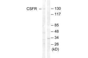 Western blot analysis of extracts from HT-29 cells, using CSFR (Ab-809) antibody. (CSF1R anticorps  (Tyr809))