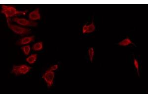 ABIN6274433 staining HeLa by IF/ICC. (ANKK1 anticorps  (Internal Region))