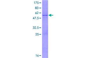 Image no. 1 for Coenzyme Q Biosynthesis Protein 7 (Coq7) (AA 1-217) protein (GST tag) (ABIN1350081)