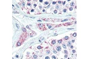 IHC analysis of FFPE human testis tissue stained with LIN28B antibody