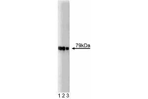 Western blot analysis of AKAP79 on SW13 lysate. (AKAP5 anticorps  (AA 180-427))