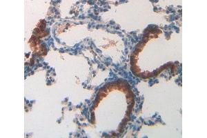 IHC-P analysis of lung tissue, with DAB staining. (MUC5B anticorps  (AA 3667-3771))