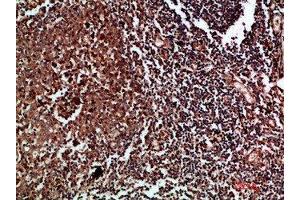 Immunohistochemical analysis of paraffin-embedded human-tonsil, antibody was diluted at 1:200
