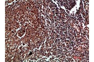 Immunohistochemical analysis of paraffin-embedded human-tonsil, antibody was diluted at 1:200 (CDK6 anticorps  (AA 280-325))
