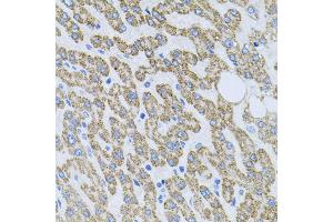 Immunohistochemistry of paraffin-embedded human liver injury using NTF4 antibody (ABIN5970439) at dilution of 1/100 (40x lens).
