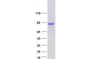 Validation with Western Blot