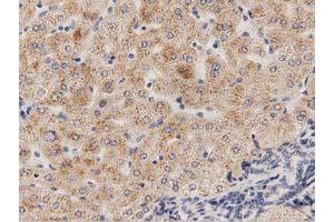 Immunohistochemical staining of paraffin-embedded Human bladder tissue using anti-PECR mouse monoclonal antibody. (PECR anticorps)