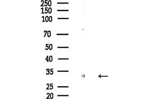 anti-Histone H1.4 (HIST1H1E) (pThr18) antibody
