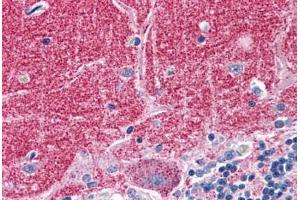 Human Brain, Cerebellum: Formalin-Fixed, Paraffin-Embedded (FFPE) (Septin 3 anticorps  (AA 15-26))