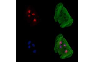ABIN6261546 and ABIN6278460 staining  cells by IF/ICC.