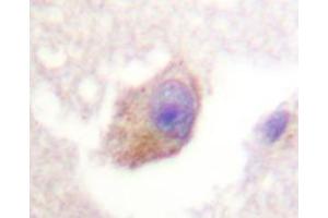 Immunohistochemistry analyzes of TPH1 antibody in paraffin-embedded human brain tissue. (Tryptophan Hydroxylase 1 anticorps)