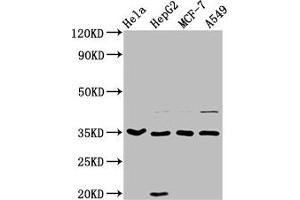 Western Blot Positive WB detected in: Hela whole cell lysate, HepG2 whole cell lysate, MCF-7 whole cell lysate, A549 whole cell lysate All lanes: AIMP1 antibody at 3. (AIMP1 anticorps  (AA 25-180))
