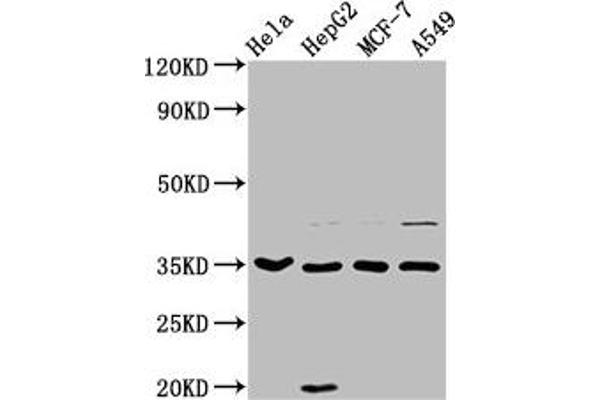 AIMP1 anticorps  (AA 25-180)