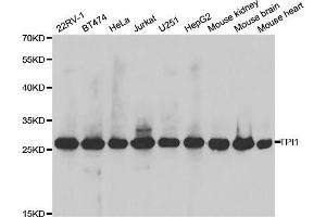 Western blot analysis of extracts of various cell lines, using TPI1 antibody. (TPI1 anticorps)