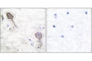 Immunohistochemistry analysis of paraffin-embedded human brain tissue, using Parkin Antibody. (Parkin anticorps  (AA 1-50))